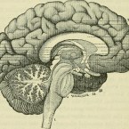 HEAD CHECK: The one and only brain surgery musical, 'A New Brain' opens at Tabard Theatre Friday.